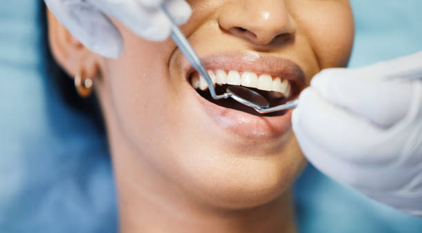 Best Emergency Dental Care for Broken or Chipped Teeth in Woody, WA